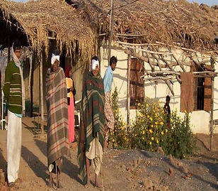 Initial IPD: patients outside a thatched building
